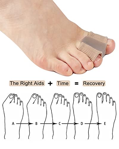 Golbylicc Bunion Toe Separators for Overlapping Toes Women Men, Gel Toe Spacers Bunion Corrector with 2 Loops for feet, Hammer Toe Straightener (2PC)