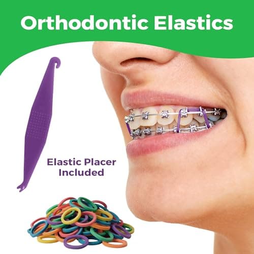 Orthodontic Rubber Bands for Braces 3/16 Heavy Force 4.5 oz - 100 Pack, Neon, Elastic Braces Rubber Bands, Orthodontic Elastics for Fixing Tooth Gaps, Dreadlocks, Includes Free Elastic Placer