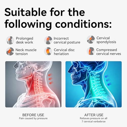 Owlprince Posture Corrector for Neck & Cervical Spine Alignment - 360° Adjustable Neck Collar with 28 Levels, Memory Foam Support for Pain Relief, Tech Neck, Hump & Forward Head Posture (Gray, Large)